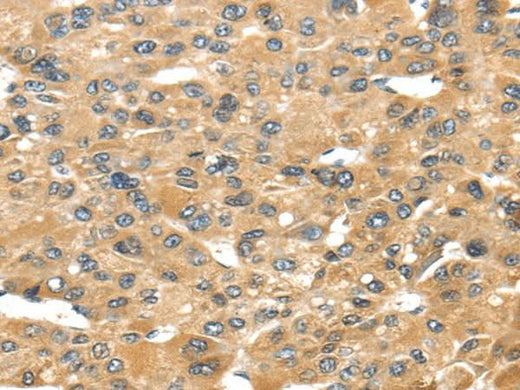Anti-Human UCP1 Antibody - ABMIUM