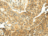 Anti-Human SERPINA12 Antibody - ABMIUM