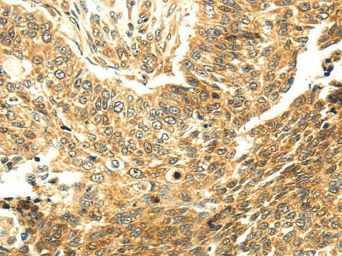 Anti-Human SERPINA12 Antibody - ABMIUM