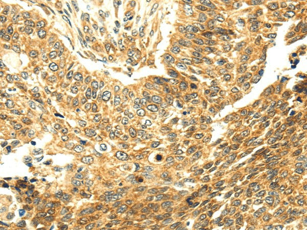 Anti-Human SERPINA12 Antibody - ABMIUM