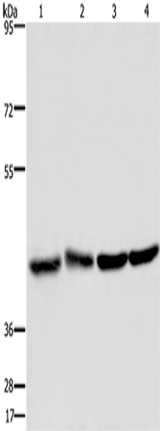 Anti-Human/Mouse DRG1 Antibody - ABMIUM