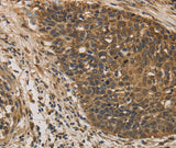 Anti-Human/Mouse DACH1 Antibody - ABMIUM