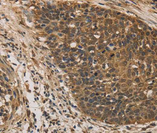 Anti-Human/Mouse DACH1 Antibody - ABMIUM