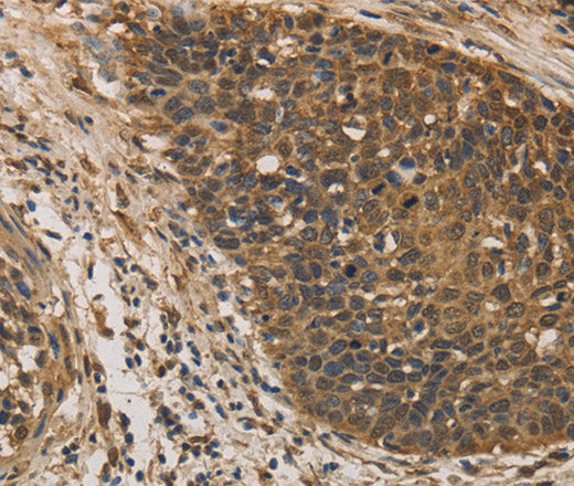 Anti-Human/Mouse DACH1 Antibody - ABMIUM