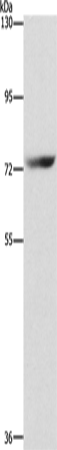 Anti-Human SENP1 Antibody - ABMIUM