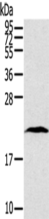 Anti-Human/Mouse TAF10 Antibody - ABMIUM