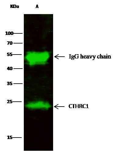 Anti-Human CTHRC1 Antibody [B155] - ABMIUM