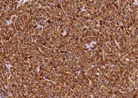 Anti-Human S100B Antibody [B219] - ABMIUM