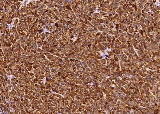 Anti-Human S100B Antibody [B219] - ABMIUM
