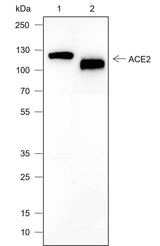 Anti-Human/Mouse ACE2 Antibody [A708]