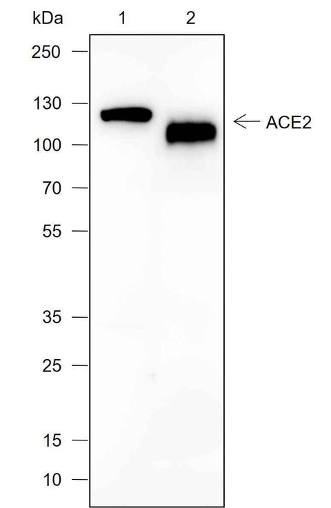 Anti-Human/Mouse ACE2 Antibody [A708] - ABMIUM