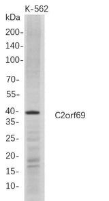 Anti-Human C2orf69 Antibody [B687]