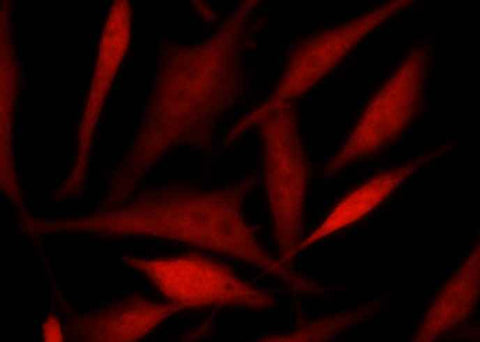 Anti-Human TSC22D1 Antibody [B354] - ABMIUM