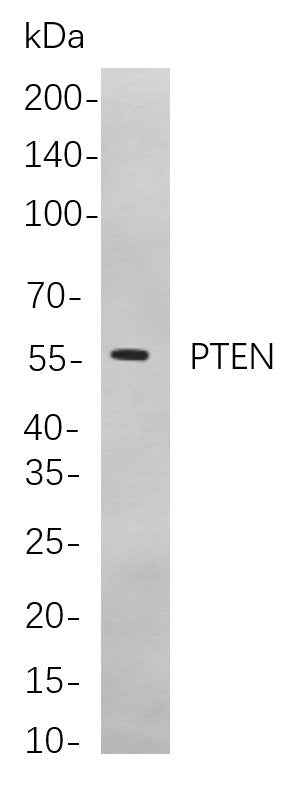 Anti-Human/Mouse/Rat PTEN Antibody [B777] - ABMIUM