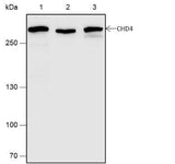 Anti-Human/Rat/Mouse CHD4 Antibody [A649]