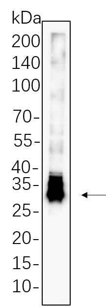 Anti-Human/Mouse/Rat DARPP-32 Antibody [B556] - ABMIUM