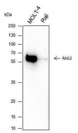 Anti-Human/Mouse RAG2 Antibody [A350]