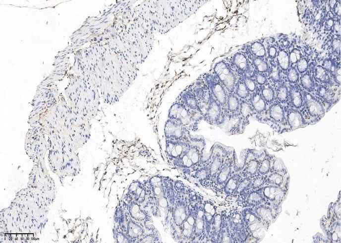 Anti-Mouse PDGFRA Antibody [B510] - ABMIUM