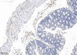 Anti-Mouse PDGFRA Antibody [B510]