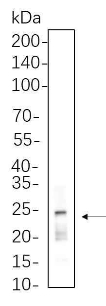 Anti-Human/Mouse/Rat Rab11 Antibody [B1075] - ABMIUM