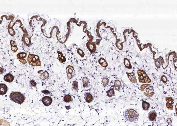 Anti-Mouse TACSTD2 Antibody [B495] - ABMIUM