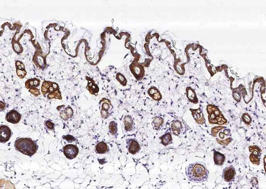 Anti-Mouse TACSTD2 Antibody [B495] - ABMIUM