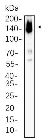 Anti-Human/Mouse ASK1 Antibody [B751]