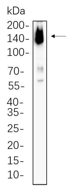Anti-Human/Mouse ASK1 Antibody [B751] - ABMIUM