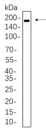 Anti-Human HER2 Antibody [B595]