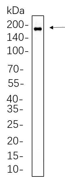 Anti-Human HER2 Antibody [B595] - ABMIUM