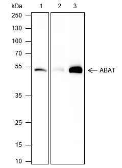 Anti-Human/Rat/Mouse ABAT Antibody [A395] - ABMIUM