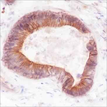 Anti-Human/Rat/Mouse FGFR2 Antibody [A221] - ABMIUM