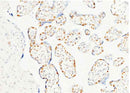 Anti-Human PARP1 Antibody [A882] - ABMIUM