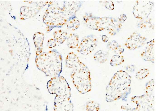 Anti-Human PARP1 Antibody [A882] - ABMIUM