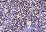 Anti-Human/Ferret CD8A Antibody [A1112] - ABMIUM