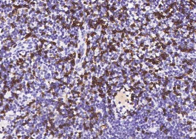 Anti-Human/Ferret CD8A Antibody [A1112] - ABMIUM