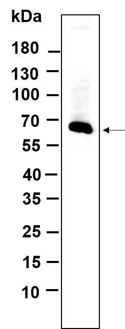 Anti-Human/Mouse/Rat MMP2 Antibody [B651] - ABMIUM