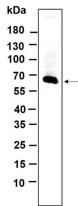 Anti-Human/Mouse/Rat MMP2 Antibody [B651]