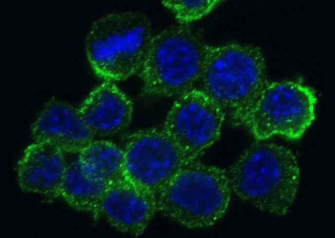 Anti-Mouse MSR1 Antibody [B410] - ABMIUM