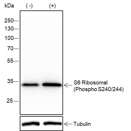 Anti-Human/Rat/Mouse Phospho-S6 Ribosomal Protein (Ser240, 244) Antibody [A802] - ABMIUM