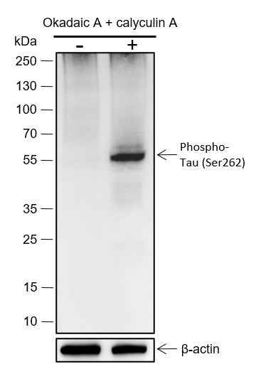 Anti-Human Phospho-Tau (S262) Antibody [A408] - ABMIUM