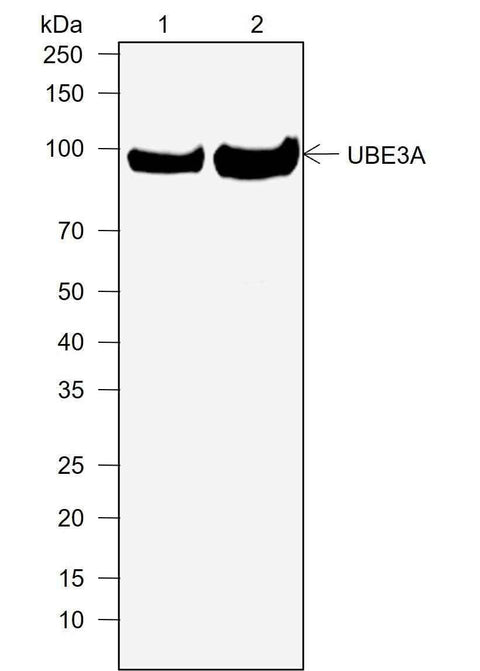 Anti-Human UBE3A Antibody [A758] - ABMIUM