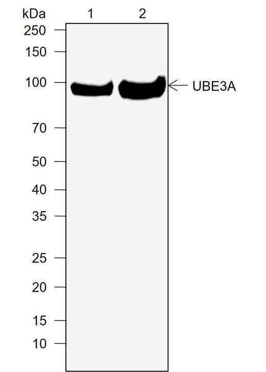 Anti-Human UBE3A Antibody [A758] - ABMIUM