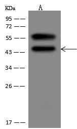 Anti-Human SERPINB3 Antibody [A1078] - ABMIUM