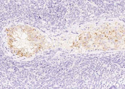 Anti-Human AMH Antibody [A996] - ABMIUM