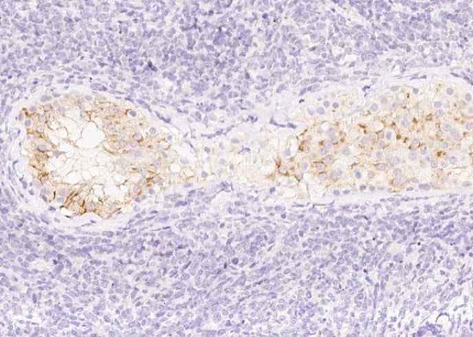 Anti-Human AMH Antibody [A996] - ABMIUM