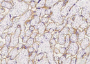 Anti-Human INSR Antibody [A881] - ABMIUM