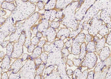 Anti-Human INSR Antibody [A881] - ABMIUM