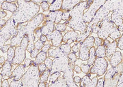 Anti-Human INSR Antibody [A881] - ABMIUM
