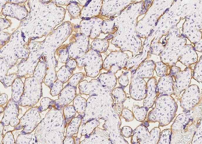 Anti-Human INSR Antibody [A881] - ABMIUM